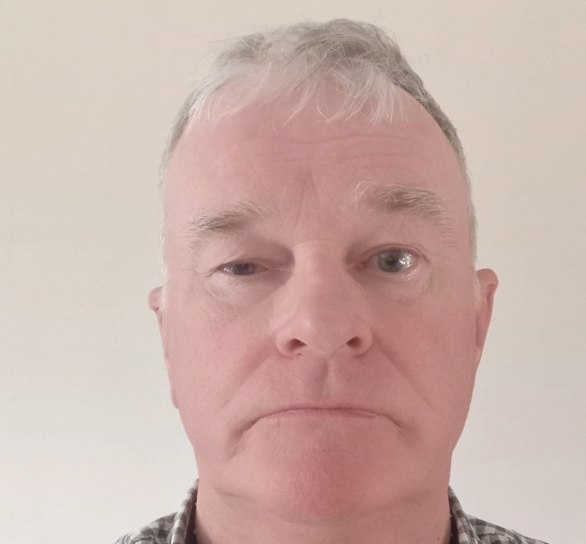 Mr Hutchinson lost vision after negligent cataract surgery at ACES